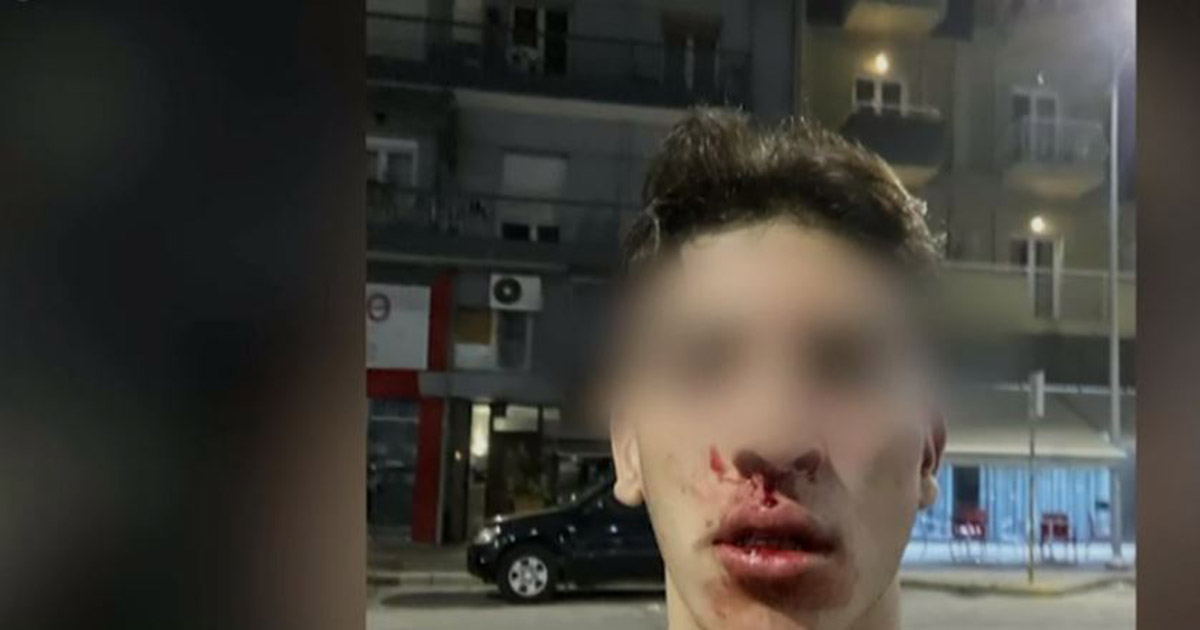 Θεσσαλονίκη- ξυλοδαρμός