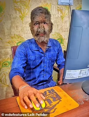 Ινδία Λυκάνθρωπος