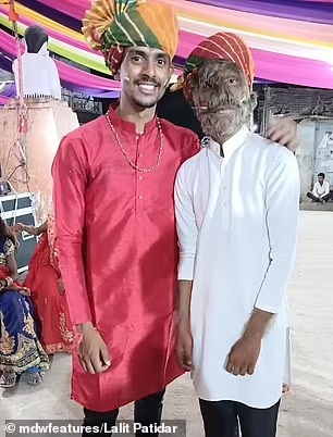 Ινδία Λυκάνθρωπος