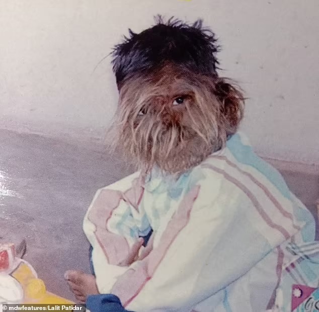 Ινδία Λυκάνθρωπος