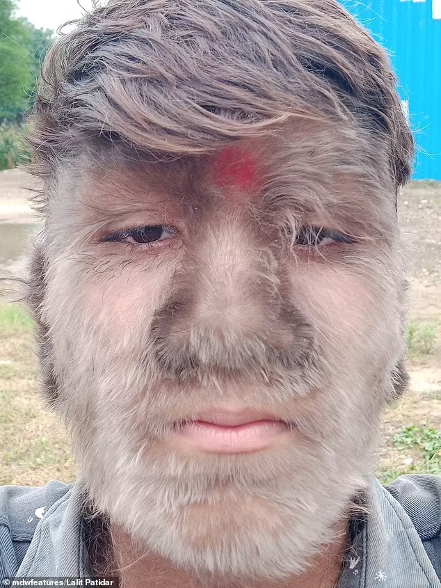 Ινδία Λυκάνθρωπος