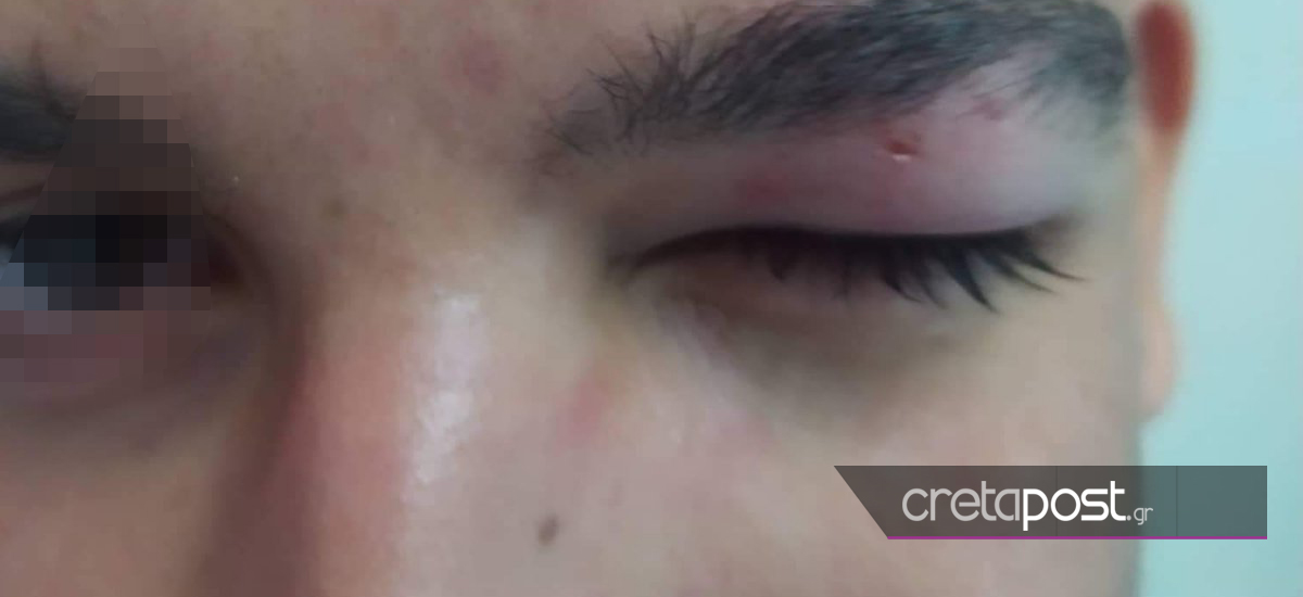 Κρήτη ξυλοδαρμός μαθητή 