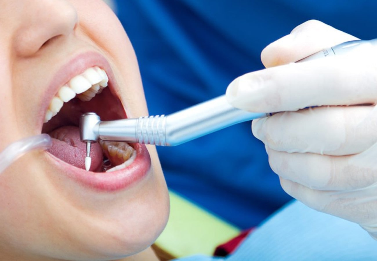 δόντια οδοντίατροι