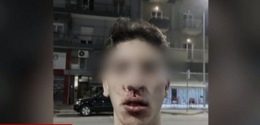 Θεσσαλονίκη: Βίντεο από την επίθεση σε ζευγάρι στα Λαδάδικα – Τραμπούκοι ξυλοκόπησαν 22χρονο
