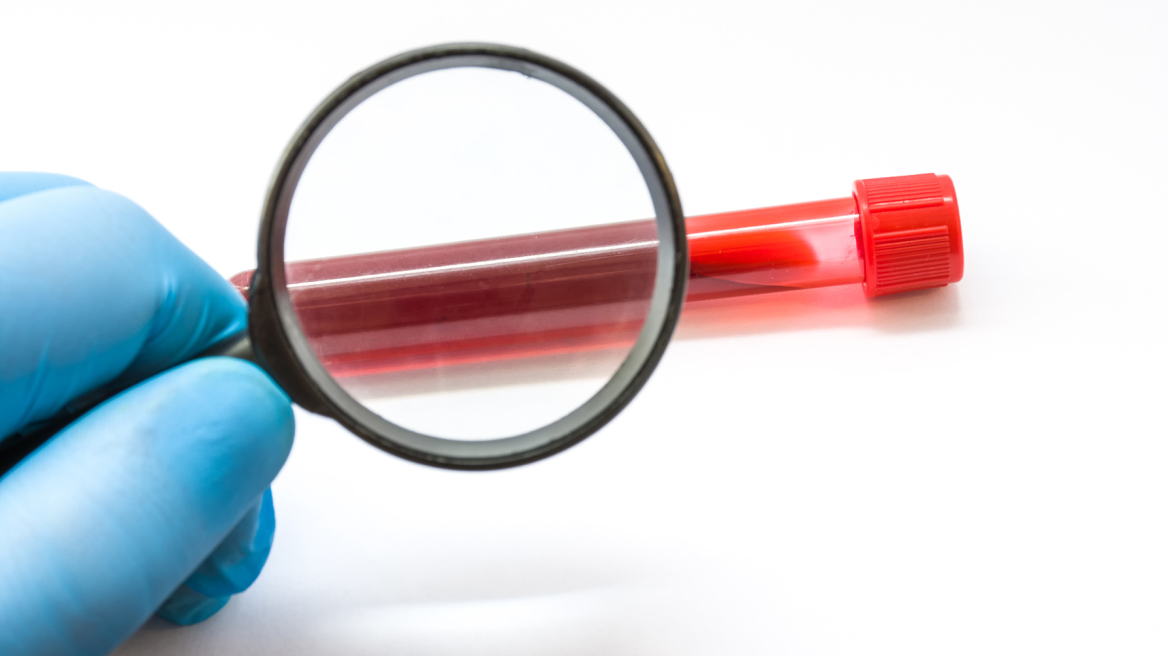 σιδηροπενία