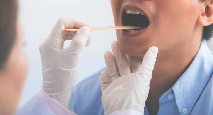 Στρεπτόκκοκος