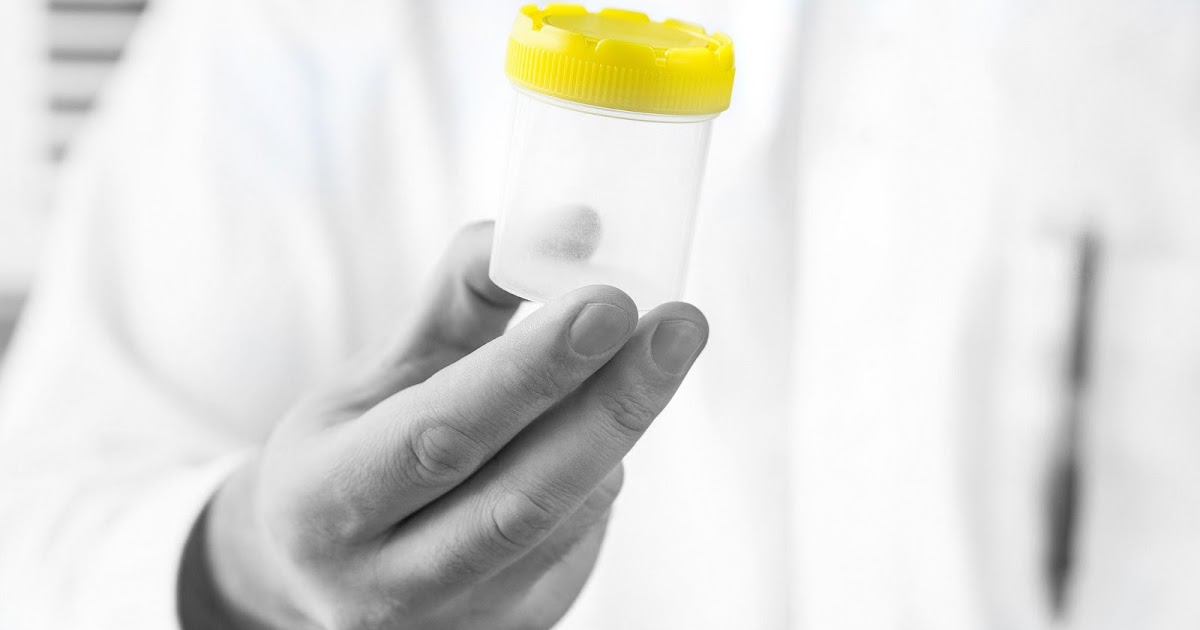 Μόνο το 4% των υποψήφιων ανδρών γίνονται δεκτοί ως δωρητές σπέρματος – Πού οφείλεται το μεγάλο ποσοστό απόρριψης