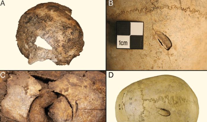 Ανθρωπολογία