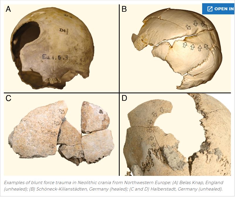 Ανθρωπολογία