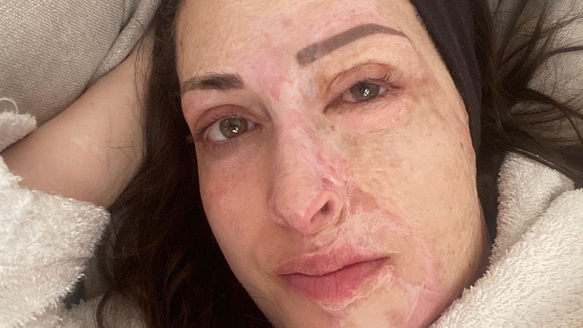 Ιωάννα Παλιοσπύρου: Συγκλονιστική ανάρτηση – «Ακόμα παλεύω να αποδεχτώ τον νέο μου εαυτό»