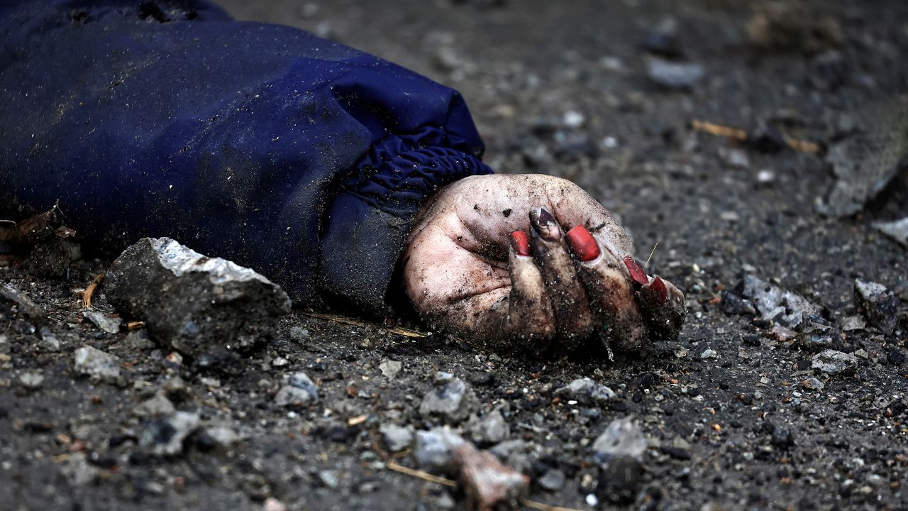 Η Ίρινα Φίλκινα με τα κόκκινα νύχια έγινε σύμβολο του πολέμου στην Ουκρανία