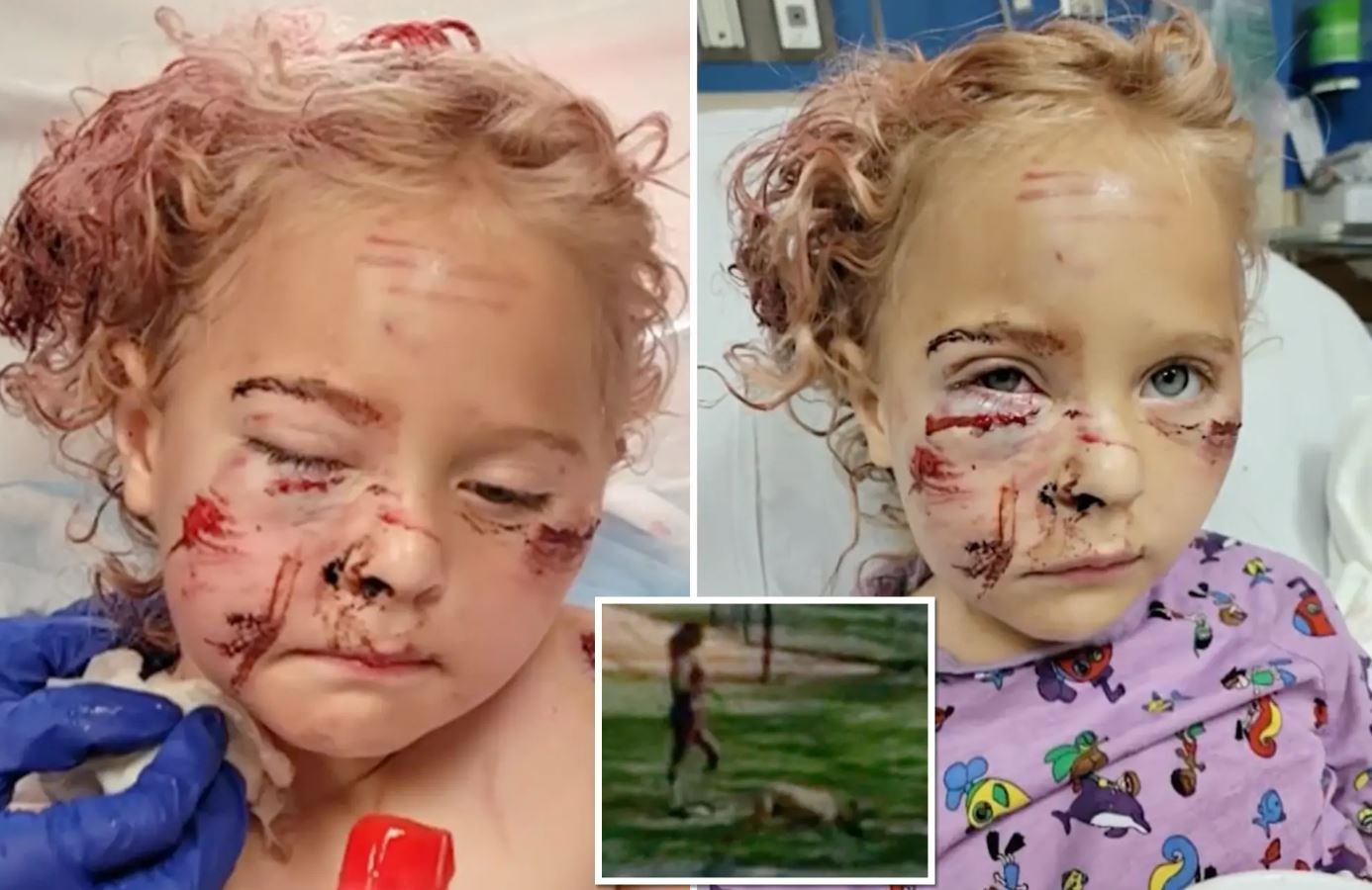 επίθεση σκύλου ΗΠΑ