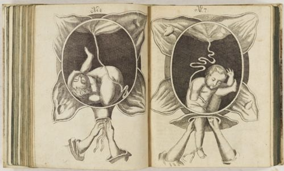 Justine Siegemund The Court Midwife 2