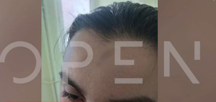 Τροχαίο στην Νέα Μάκρη