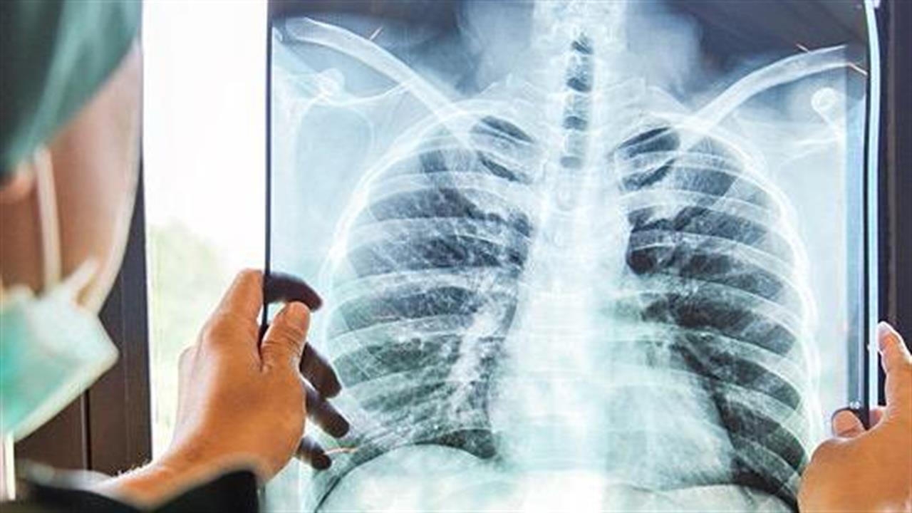 Έρευνα: Μια σοβαρή αναπνευστική λοίμωξη σε μικρή ηλικία αυξάνει τον κίνδυνο πρόωρου θανάτου των ενηλίκων