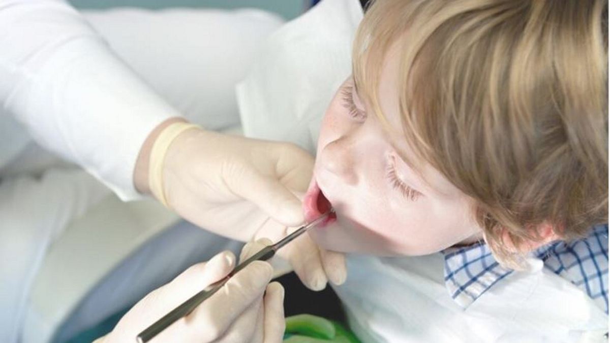 Dentist Pass: Τι είναι και πώς θα λειτουργεί – Πότε θα το πάρουν οι γονείς