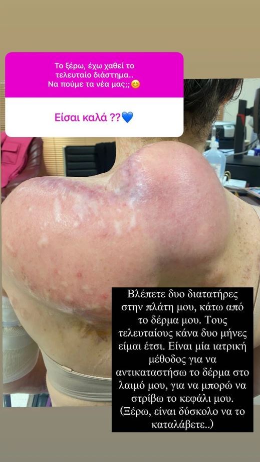 Παλιοσπύρου