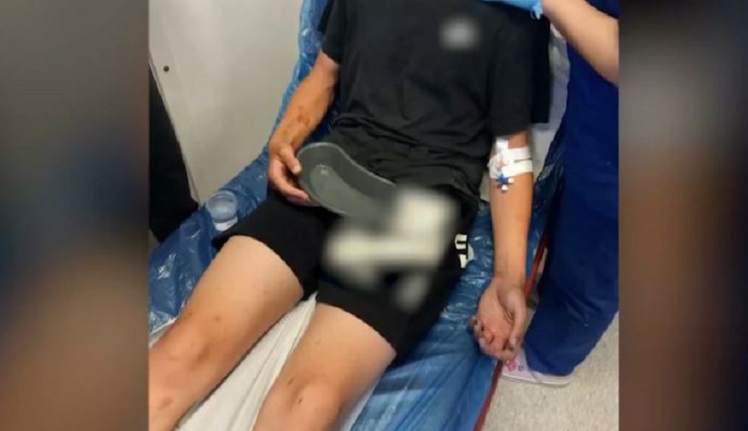 Ξυλοδαρμός 16χρονου στην Καλαμάτα