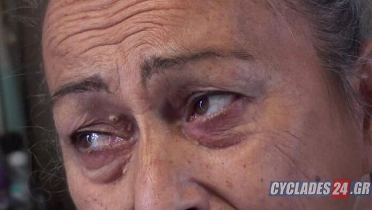 Πάρος: Ανήλικος επιτέθηκε σε ηλικιωμένη με κινητικά προβλήματα