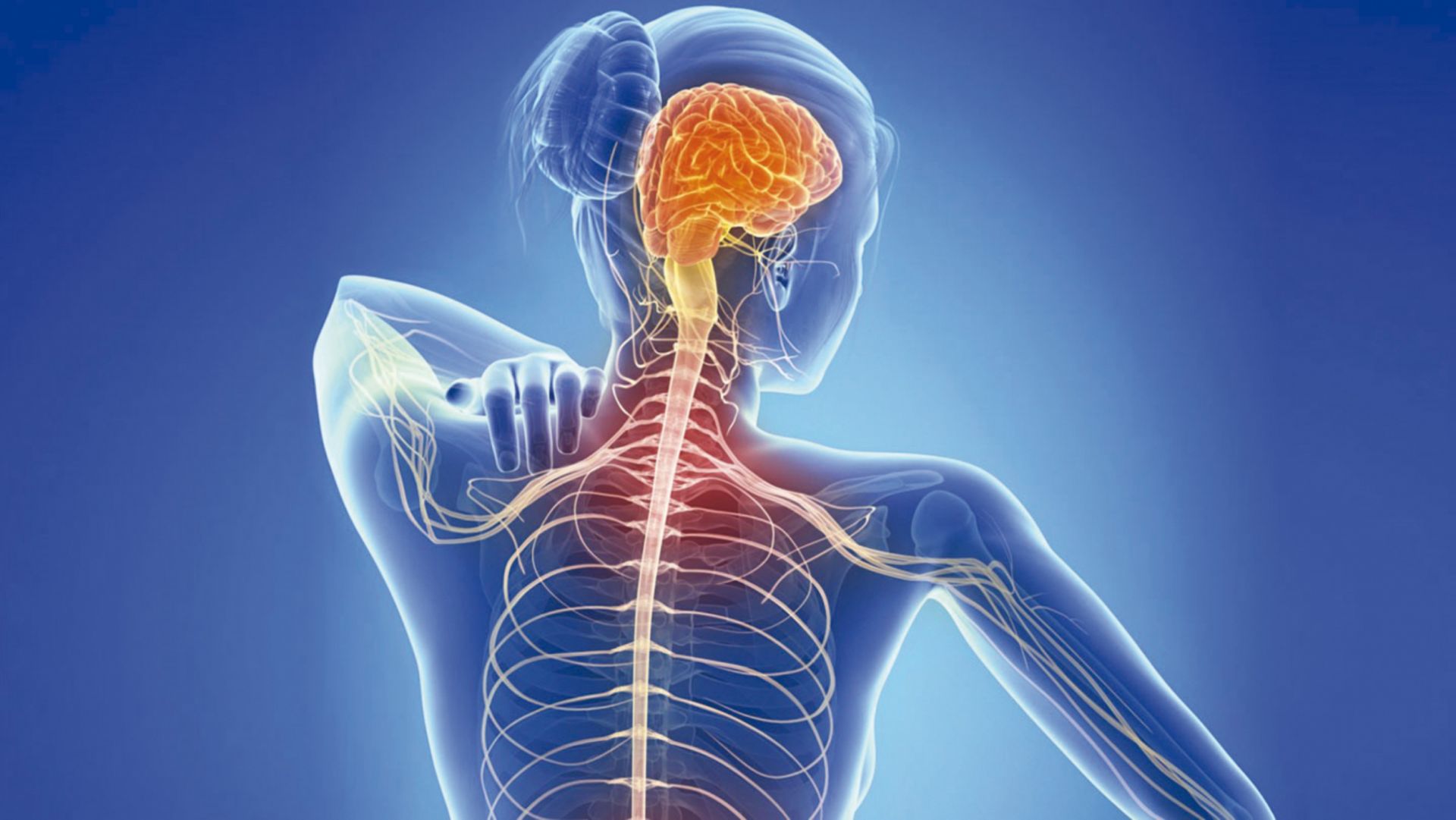 σκλήρυνση κατά πλάκας