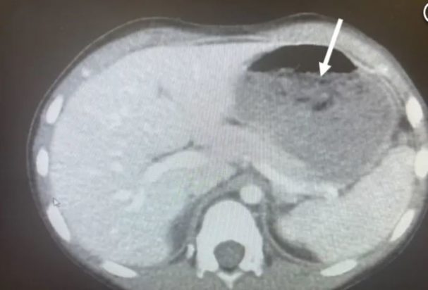 Ακτινογραφία