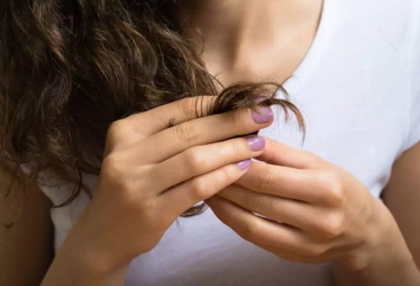 14χρονη με σύνδρομο Rapunzel στην Θεσσαλονίκη