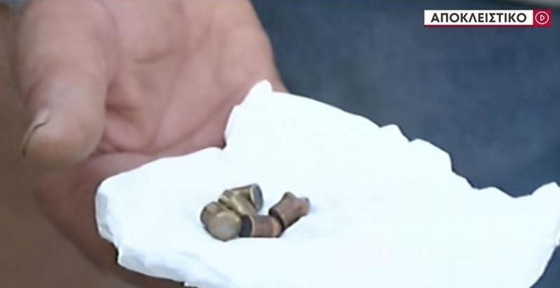 Άνω Λιόσια: Αδέσποτη σφαίρα τον τραυμάτισε στο πόδι – «Αν ήμουν λίγο πιο μπροστά θα με πετύχαινε στο κεφάλι»