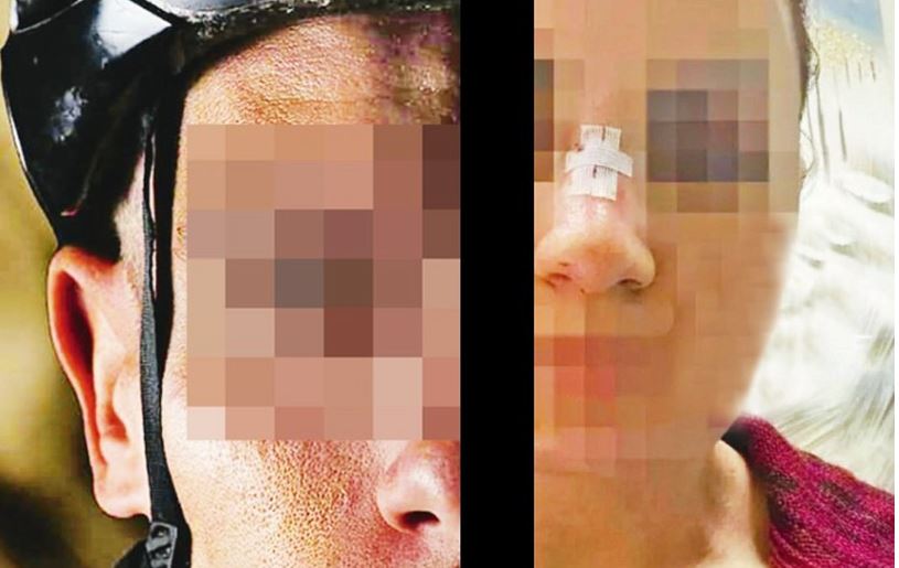 Βόλος: Καλείται σε απολογία ο πρωταθλητής ποδηλασίας που ξυλοκόπησε την πρώην σύζυγό του