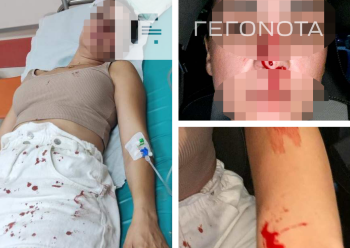 Ξυλοδαρμός Βόλος