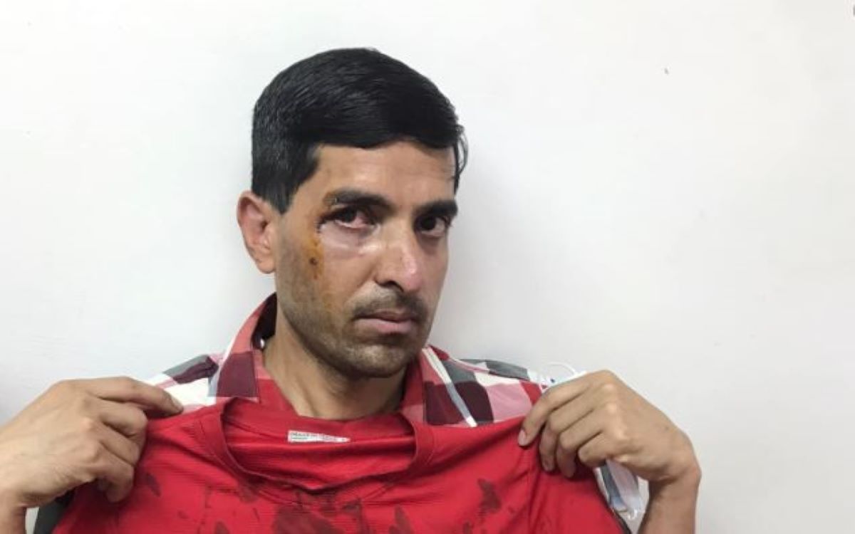 μετανάστης ξυλοδαρμός