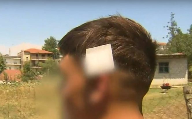 Πυροβολισμοί στη Χαλκιδική