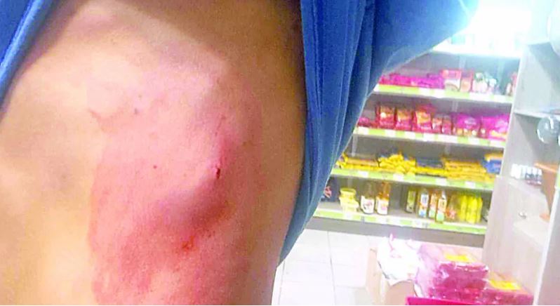 Πάτρα: Επίθεση με μαχαίρι σε 33χρονο