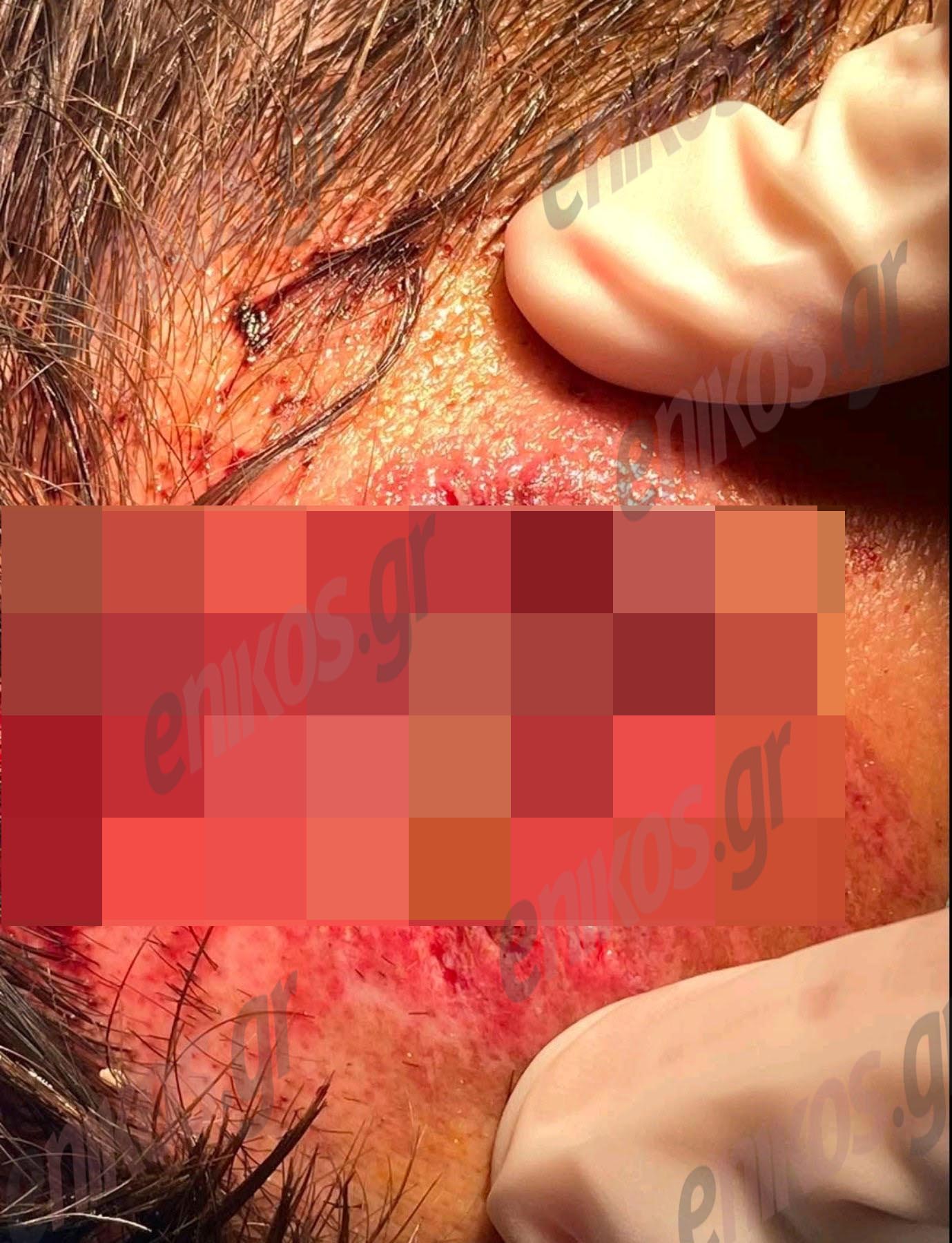 Τραυματίας αστυνομικός στον Ασπρόπυργο