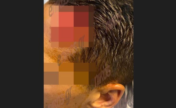 Τραυματίας αστυνομικός στον Ασπρόπυργο