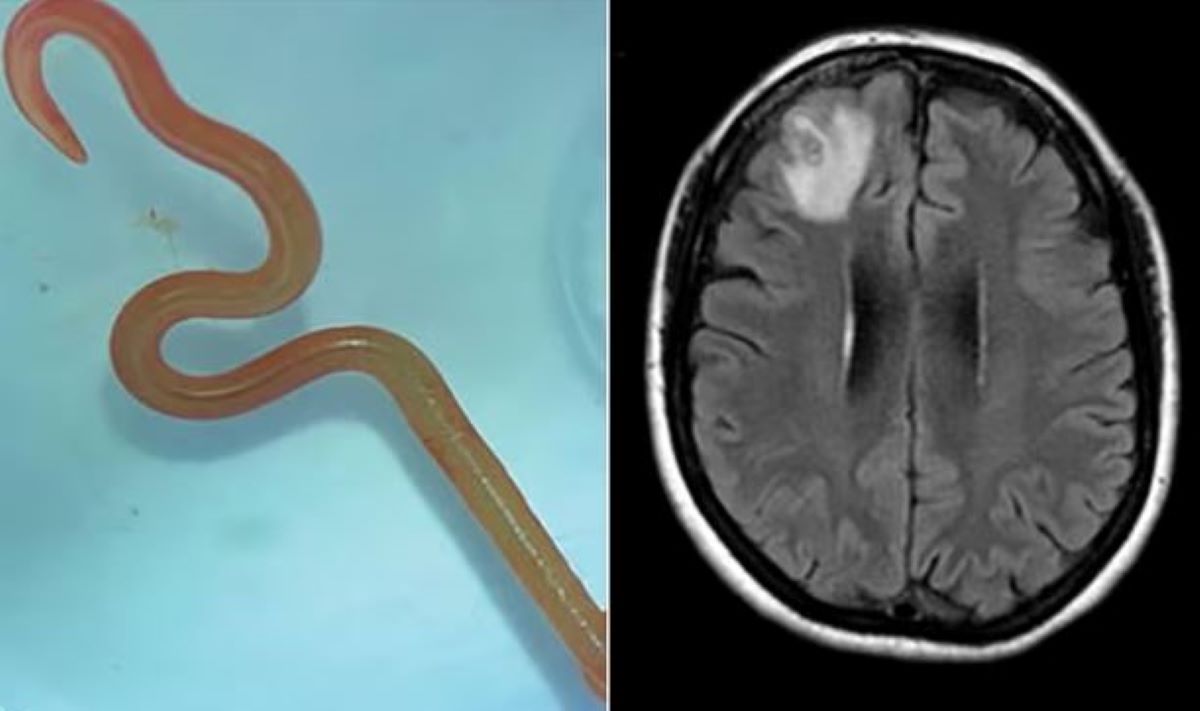 Σκουλήκι μαγνητική