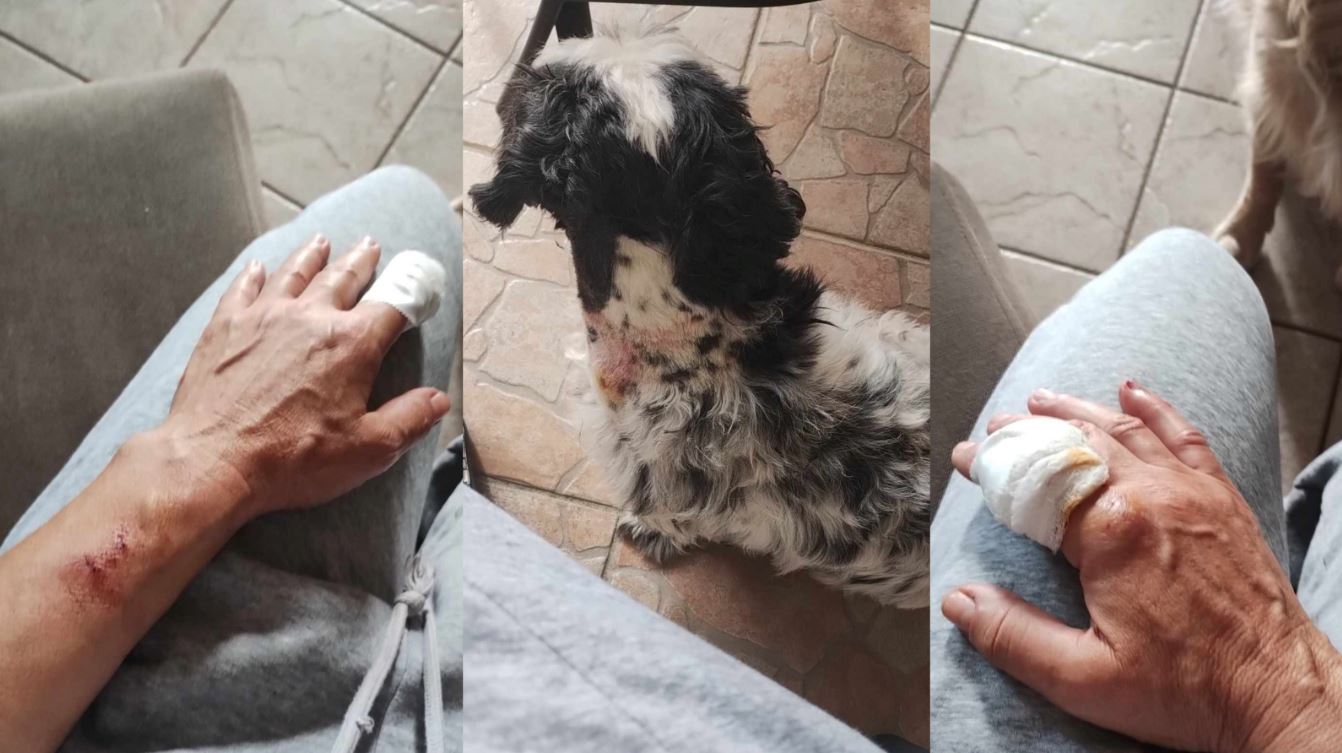 Ηγουμενίτσα: Γυναίκα δέχθηκε επίθεση από πιτ μπουλ όσο έκανε βόλτα με το σκυλάκι της