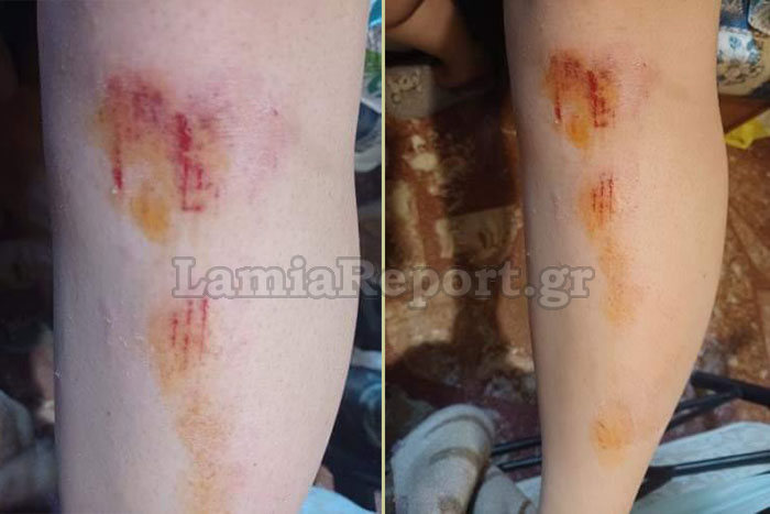 Λαμία Τρύπα