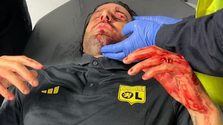 Αναβλήθηκε το Μαρσέιγ – Λιόν: Επίθεση με πέτρες στο πούλμαν των φιλοξενούμενων – Τραυματίστηκε ο προπονητής τους