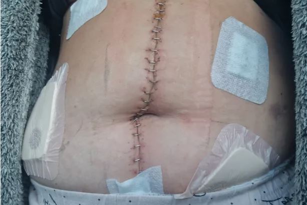 γυναίκα σπάνια ασθένεια