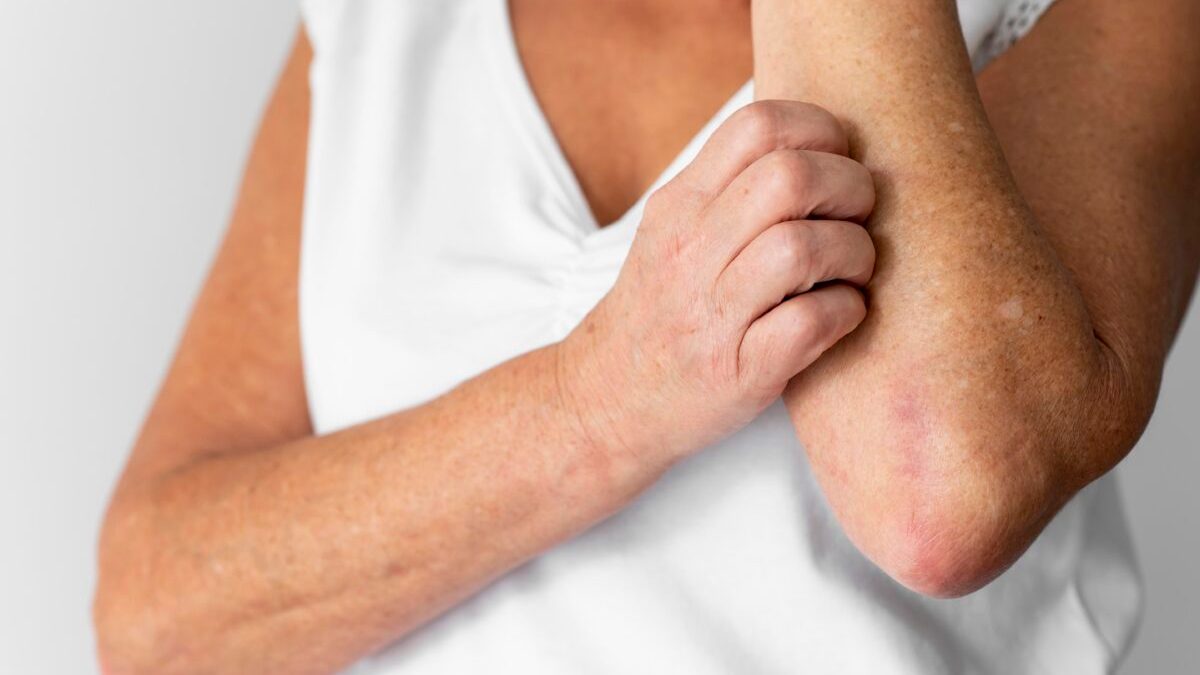 Γιατί έχουμε φαγούρα και πώς μπορούμε να σταματήσουμε το ξύσιμο; Νέα μελέτη λύνει το μυστήριο