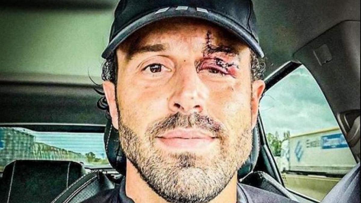 Λυών: Ο Φάμπιο Γκρόσο μίλησε για πρώτη φορά μετά τα επεισόδια – «Αυτό που συνέβη θα μπορούσε να είναι μία τραγωδία»