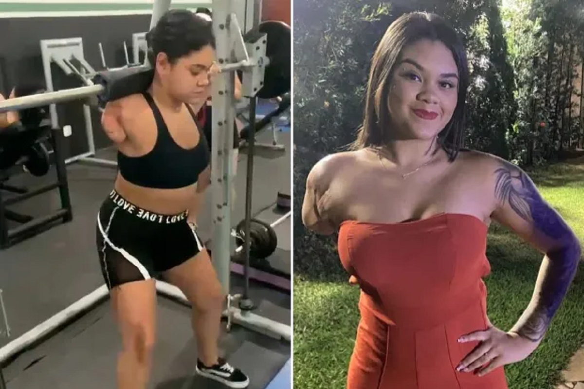 Δύναμη ψυχής από 23χρονη που έχασε το χέρι της σε φρικτό ατύχημα με λεωφορείο - Σηκώνει μέχρι και βάρη στο γυμναστήριο