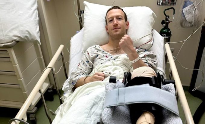 Στο χειρουργείο ο Μαρκ Ζούκερμπεργκ