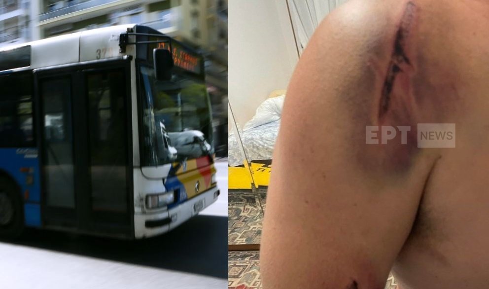 Θεσσαλονίκη: «Με χτυπούσαν στο κεφάλι και το σώμα» – Σε σοκ ο οδηγός λεωφορείου που έπεσε θύμα ξυλοδαρμού