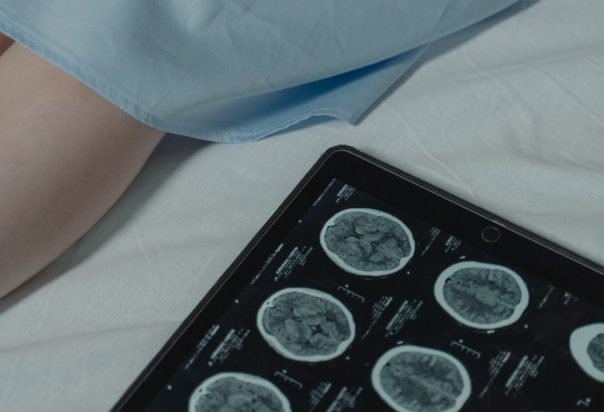 Αυτοί οι άνδρες κινδυνεύουν από 17 τύπους καρκίνου – Το κοινό χαρακτηριστικό τους