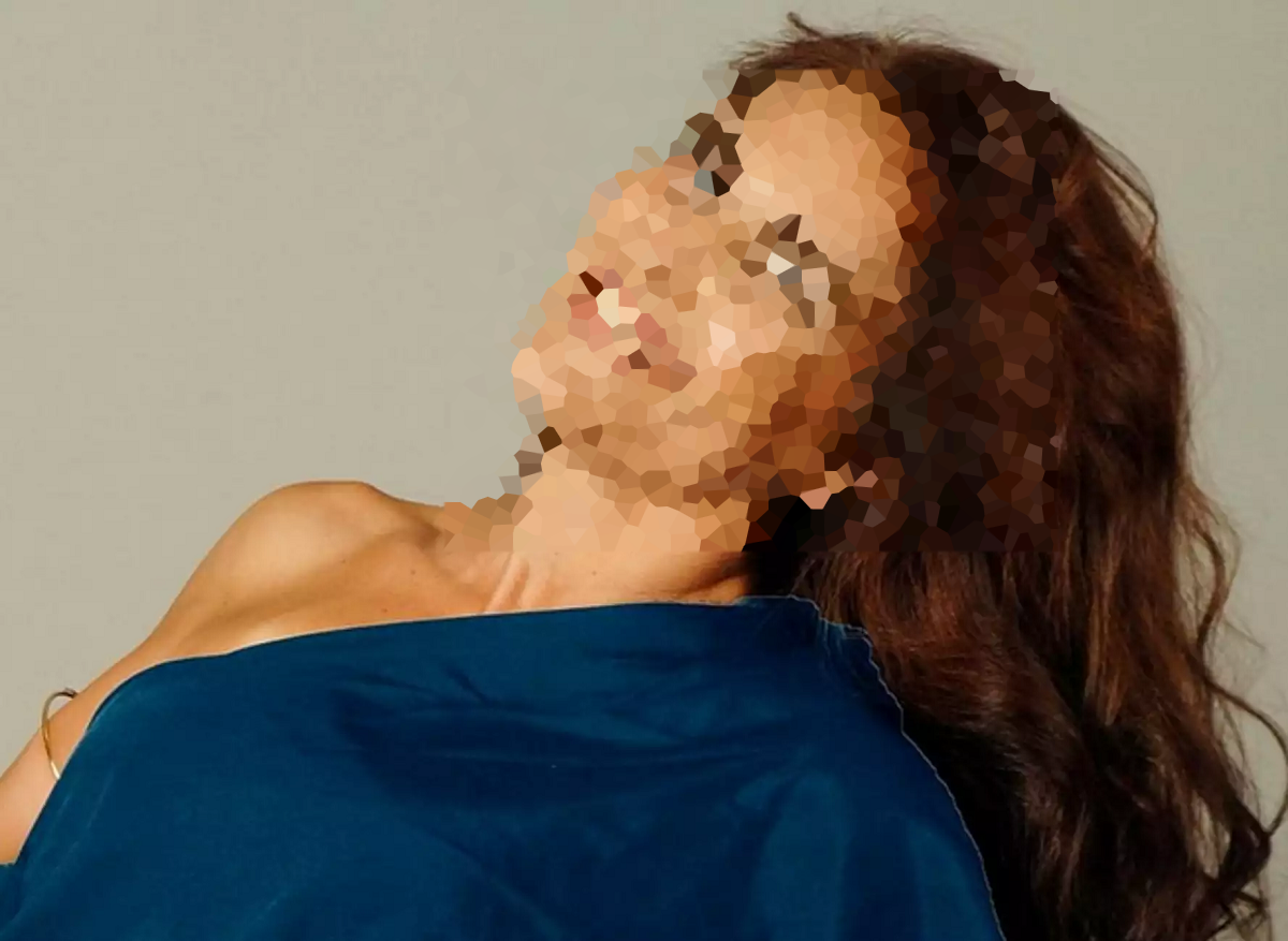 Θεσσαλονίκη: Η 50χρονη δέχθηκε πάνω από 50 δαγκωματιές από τους σκύλους - Σοκάρει η ιατροδικαστική εξέταση