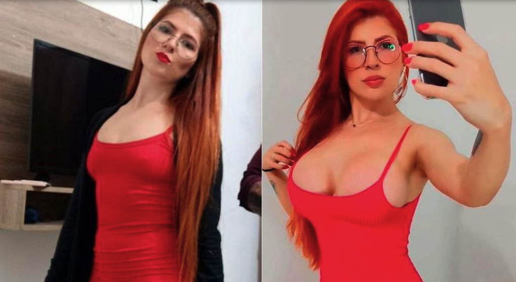 «Είμαι fitness influencer αλλά δεν με ακολουθούν για τις ασκήσεις»- Πώς η πλαστική στήθους άλλαξε τη ζωή της