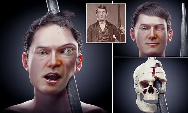 Phineas Gage: Οι επιστήμονες ανακατασκευάζουν το πρόσωπο του – Το φρικτό ατύχημα με ράβδο πριν από 175 χρόνια