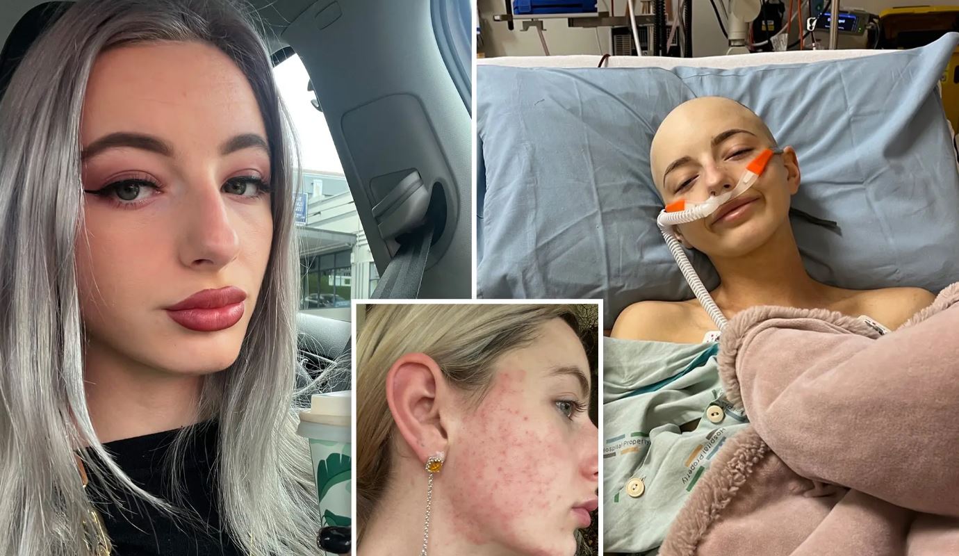 «Είχα φρικτά hangover με μόλις 2 ποτά» – Το σοκ όταν έμαθε ότι είχε καρκίνο