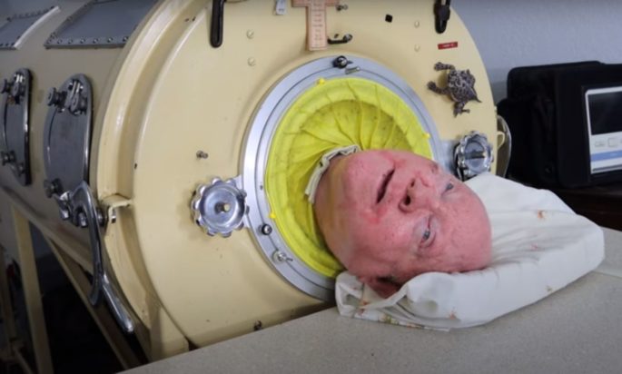 πολ αλεξαντερ σιδερενιος πνευμονας